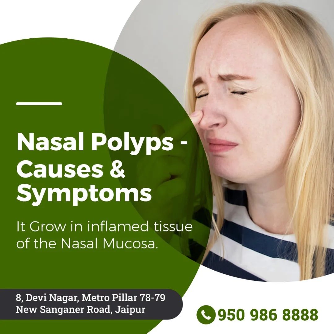 Nasal Polyps - Causes & Symptoms